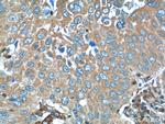 RRBP1 Antibody in Immunohistochemistry (Paraffin) (IHC (P))