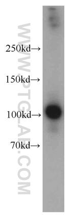 RRBP1 Antibody in Western Blot (WB)