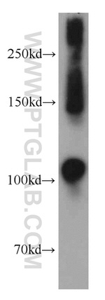 RRBP1 Antibody in Western Blot (WB)