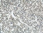 VAT1 Antibody in Immunohistochemistry (Paraffin) (IHC (P))