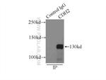 N-cadherin Antibody in Immunoprecipitation (IP)