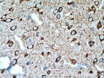 DRD2 Antibody in Immunohistochemistry (Paraffin) (IHC (P))