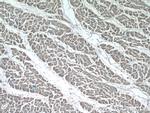 NPHP3 Antibody in Immunohistochemistry (Paraffin) (IHC (P))