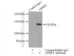 NPHP3 Antibody in Immunoprecipitation (IP)