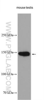 NPHP3 Antibody in Western Blot (WB)