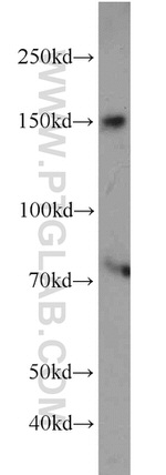 NPHP3 Antibody in Western Blot (WB)