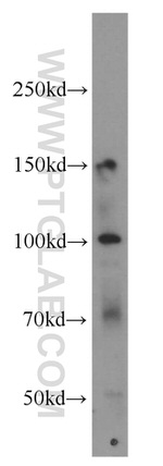 NPHP3 Antibody in Western Blot (WB)