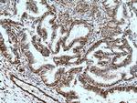 Vimentin Antibody in Immunohistochemistry (Paraffin) (IHC (P))
