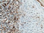Vimentin Antibody in Immunohistochemistry (Paraffin) (IHC (P))