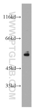 Vimentin Antibody in Western Blot (WB)