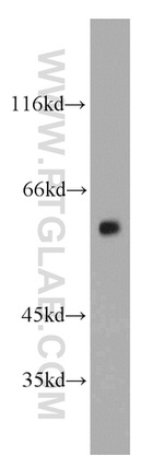 Vimentin Antibody in Western Blot (WB)