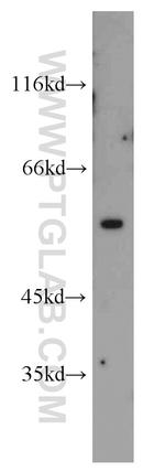 Vimentin Antibody in Western Blot (WB)