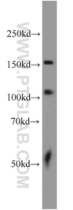 SARA Antibody in Western Blot (WB)