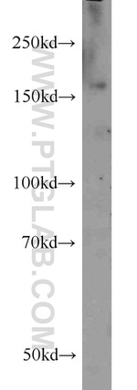 SARA Antibody in Western Blot (WB)