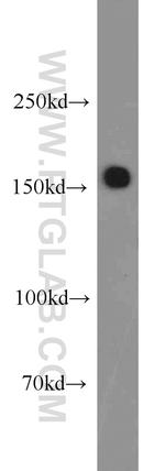 SARA Antibody in Western Blot (WB)