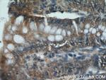 CCDC120 Antibody in Immunohistochemistry (Paraffin) (IHC (P))