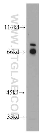 CCDC120 Antibody in Western Blot (WB)