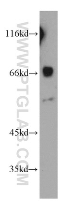 CCDC120 Antibody in Western Blot (WB)