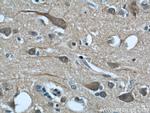 CALHM1 Antibody in Immunohistochemistry (Paraffin) (IHC (P))