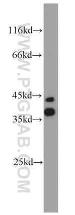 CALHM1 Antibody in Western Blot (WB)