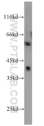 CALHM1 Antibody in Western Blot (WB)