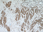 C5orf4 Antibody in Immunohistochemistry (Paraffin) (IHC (P))