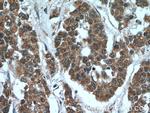 C5orf4 Antibody in Immunohistochemistry (Paraffin) (IHC (P))