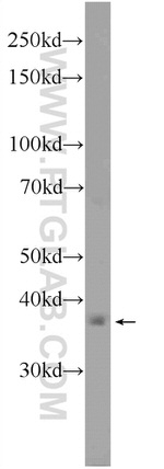 C5orf4 Antibody in Western Blot (WB)