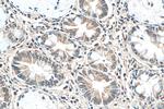 WIPF1 Antibody in Immunohistochemistry (Paraffin) (IHC (P))