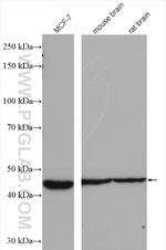 B3GALNT1 Antibody in Western Blot (WB)