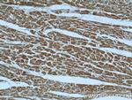 B3GALNT1 Antibody in Immunohistochemistry (Paraffin) (IHC (P))
