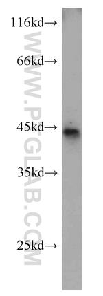 B3GALNT1 Antibody in Western Blot (WB)