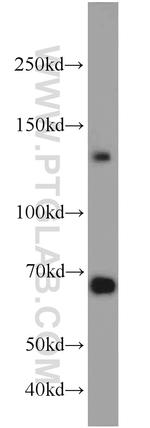 Cadherin-20 Antibody in Western Blot (WB)