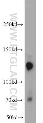 Cadherin-20 Antibody in Western Blot (WB)
