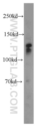 Cadherin-20 Antibody in Western Blot (WB)