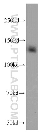 CEP97 Antibody in Western Blot (WB)