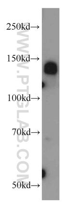 CEP97 Antibody in Western Blot (WB)