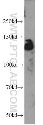 CEP97 Antibody in Western Blot (WB)