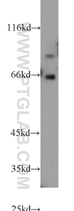 FOXP1 Antibody in Western Blot (WB)