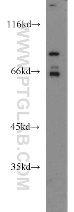 FOXP1 Antibody in Western Blot (WB)
