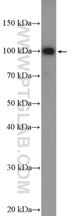 MAGED1 Antibody in Western Blot (WB)