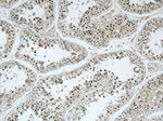 CDK8 Antibody in Immunohistochemistry (Paraffin) (IHC (P))