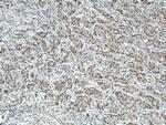 CDK8 Antibody in Immunohistochemistry (Paraffin) (IHC (P))