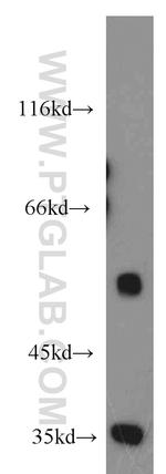 CDK8 Antibody in Western Blot (WB)
