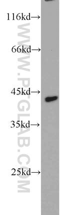 CCR10 Antibody in Western Blot (WB)