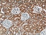 SYTL3 Antibody in Immunohistochemistry (Paraffin) (IHC (P))