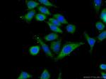 ARHGAP27 Antibody in Immunocytochemistry (ICC/IF)