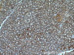 ARHGAP27 Antibody in Immunohistochemistry (Paraffin) (IHC (P))