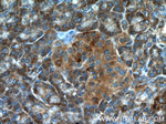 ARHGAP27 Antibody in Immunohistochemistry (Paraffin) (IHC (P))