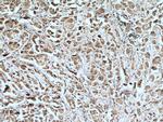 ARHGAP27 Antibody in Immunohistochemistry (Paraffin) (IHC (P))